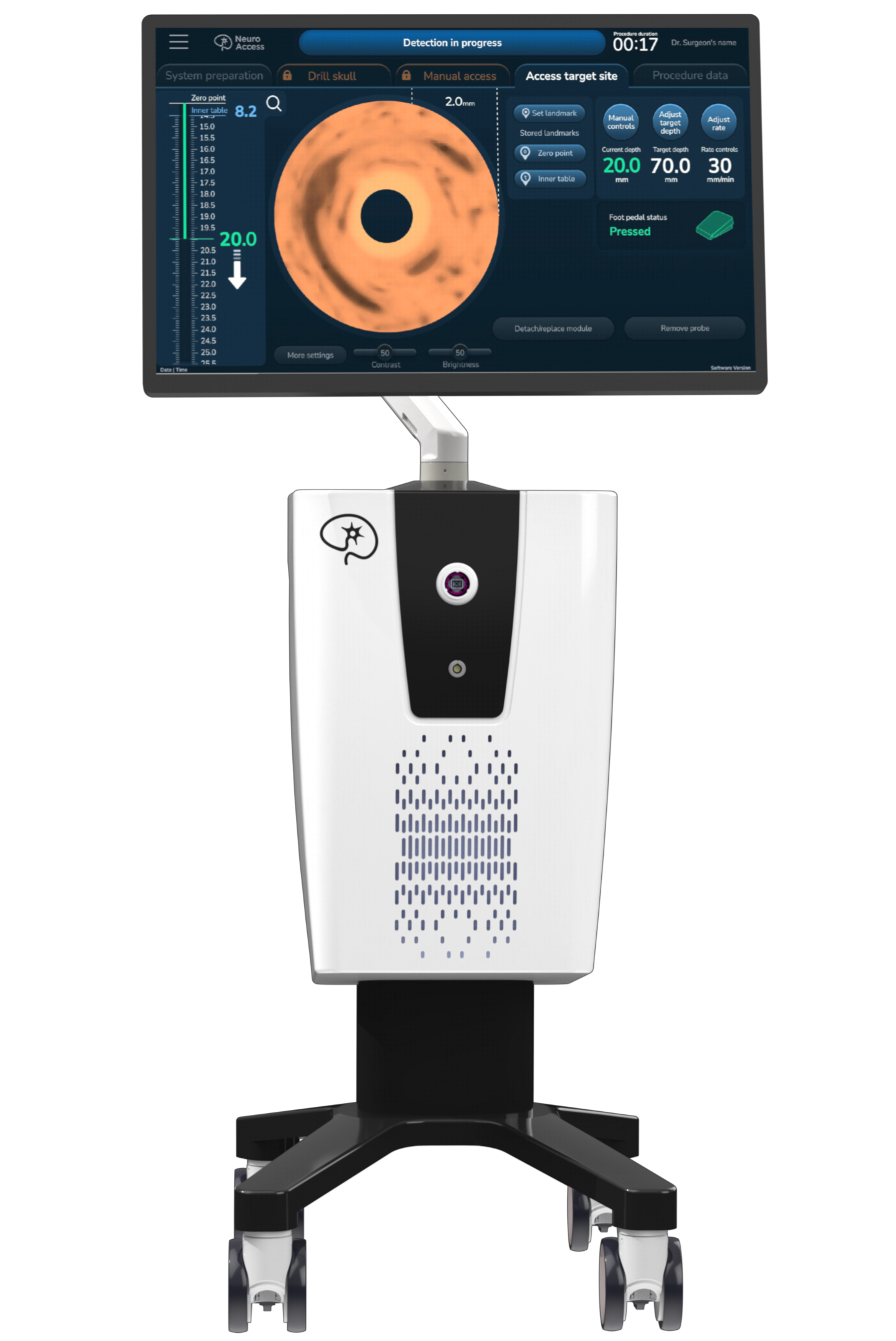 Cart neuro access